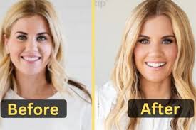 Shea_McGee_before_after
